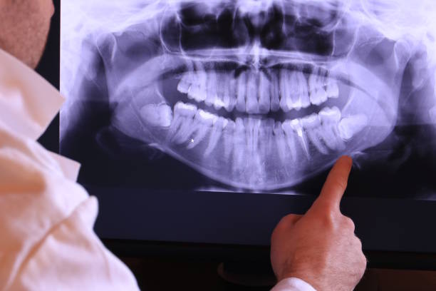 Best Emergency Treatment for Dental Infections or Abscesses in Hoxie, KS