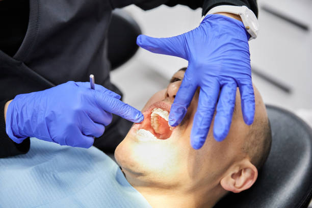 Best Emergency Root Canal Treatment in Hoxie, KS